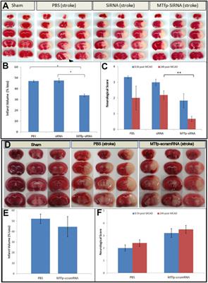 A Nanomule Peptide Carrier Delivers siRNA Across the Intact Blood-Brain Barrier to Attenuate Ischemic Stroke